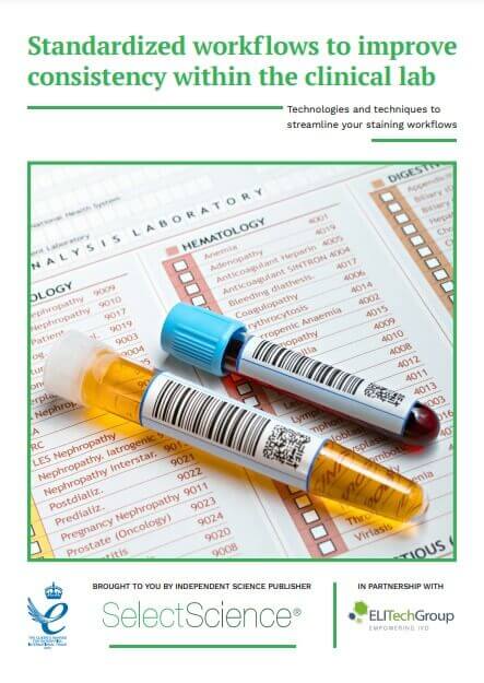 Do More in Less Time with Aerospray&reg; Cytology Staining and Cytocentrifuge Technlology